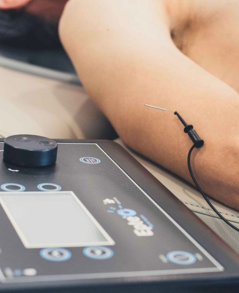 Neuromodulación Percutánea en Las Rozas