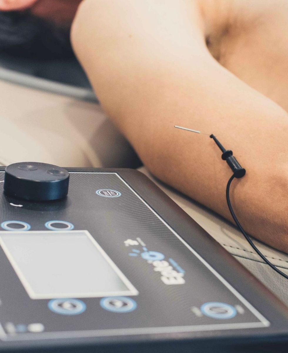 Neuromodulación Percutánea en Las Rozas